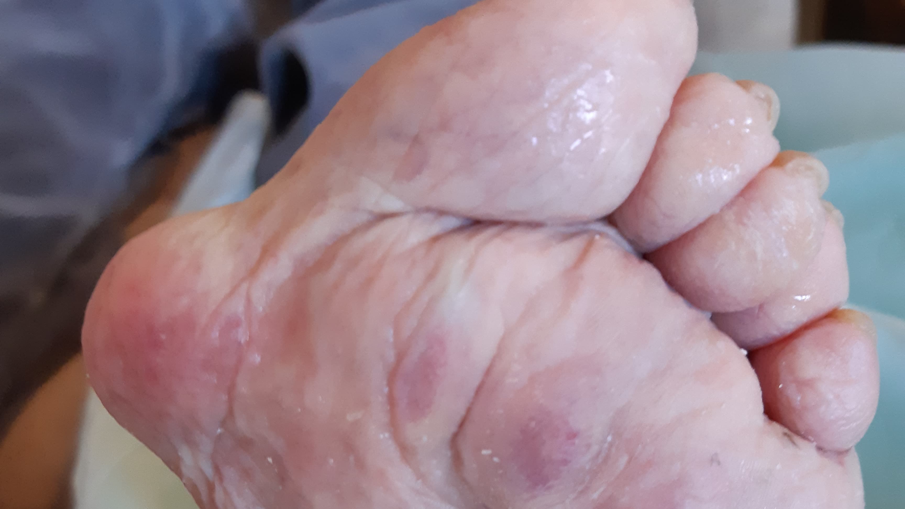 flier links 7maart 2022